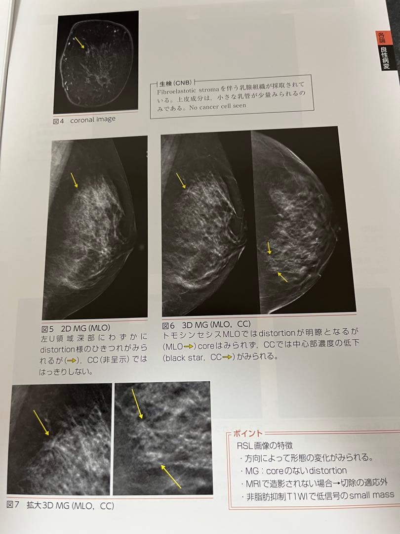 【裁断済】乳房MRIアトラス