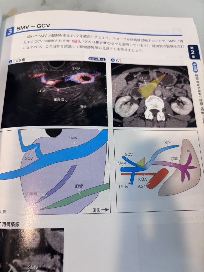 胆膵EUSセミナー 肱岡範