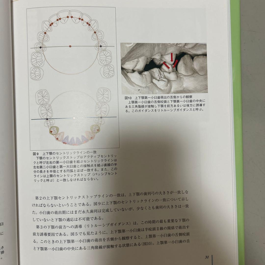 成長・発達期における不正咬合の早期治療